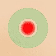 Зона вокруг трофической раны. ДЭНАС ПКМ [НЕЙРОДЭНС] 