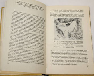 Губанов А.Г. Аллопластика. Методика вживления материала. Киев: Здоровья 1965г.