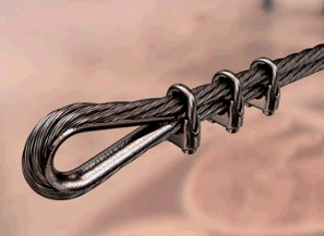 Лесби хатшысы