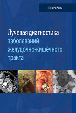 Лучевая диагностика заболеваний желудочно-кишечного тракта. Чхве Пён Ин. &quot;Издательство Панфилова&quot;. 2018