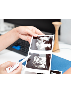 Ультразвуковое исследование малого таза