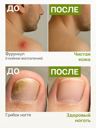 Экстракт сфагнума на ксантановой камеди 100 гр.