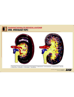 Рельефная таблица "Почка. Фронтальный разрез" (формат А1, матовое ламинир.)
