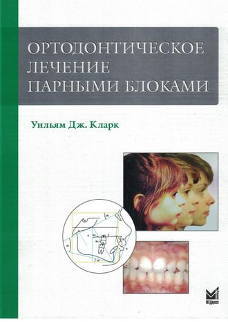 Ортодонтическое лечение парными блоками. 3-е издание. Кларк У.Дж. &quot;МЕДпресс-информ&quot;. 2022