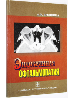 Бровкина А.Ф. Эндокринная офтальмопатия. М.: Гэотар -Медиа. 2008 г.