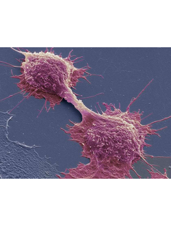 Помощь при онкологических заболеваниях