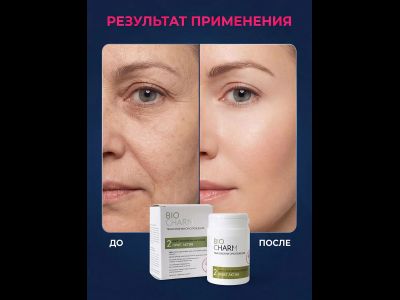 Маска 2 ЛИФТ-АКТИВ от морщин и птоза, 50 гр.