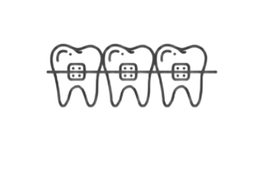 Исправление прикуса (брекеты)