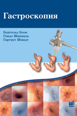 Гастроскопия. 5-е издание. Блок Б., Шахшаль Г., Шмидт Г. &quot;МЕДпресс-информ&quot;. 2024