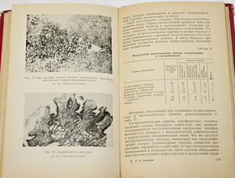 Канищев П. А. Методы диагностики заболеваний желудка. Л.: Медицина. 1964г.