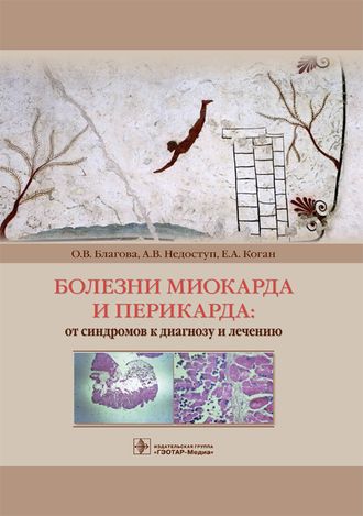 Болезни миокарда и перикарда : от синдромов к диагнозу и лечению. Благова О.В. и др. &quot;ГЭОТАР-Медиа&quot;. 2019