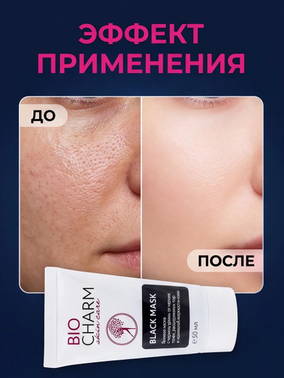 Черная маска от черных точек и прыщей, гелевая 50 мл.