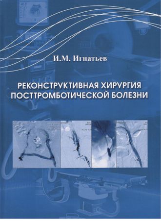 Реконструктивная хирургия посттромботической болезни. Игнатьев И.М. Издательство Казань &quot;Медицина&quot;. 2017