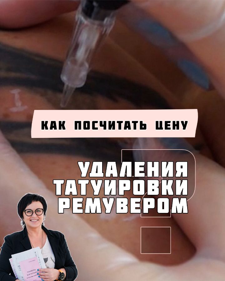 Как посчитать цену удаления татуировки ремувером?