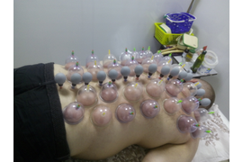 Вакуумный баночный массаж