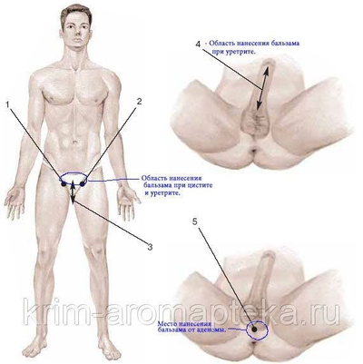 Фитокомплекс №21 для лечения аденомы предстательной железы, простатита