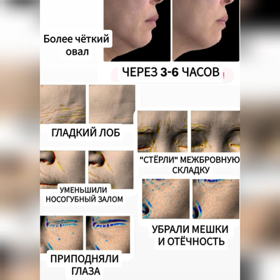 ROROBEE Маска для подтяжки нижней части лица и разглаживания лба 5 + 5шт.