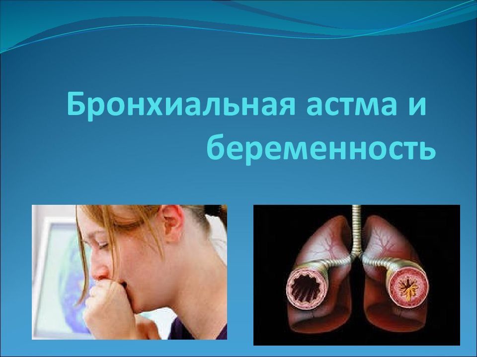 Астма и беременность. Бронхиальная астма. Бронх астма. Бронхиальная астма презентация. Презентация по теме бронхиальная астма.