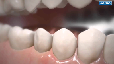 Зубная паста для ослабленных дёсен Vitis Gingival, Dentaid, 100 мл.