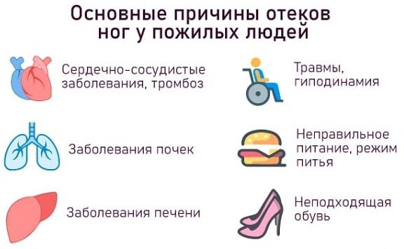 Отеки ног в щиколотке как быстро снять