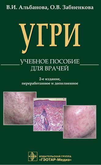 Угри. Учебное пособие для врачей. 2-е изд., перераб. и доп. Альбанова В.И., Забненкова О.В. &quot;ГЭОТАР-Медиа&quot;. 2016