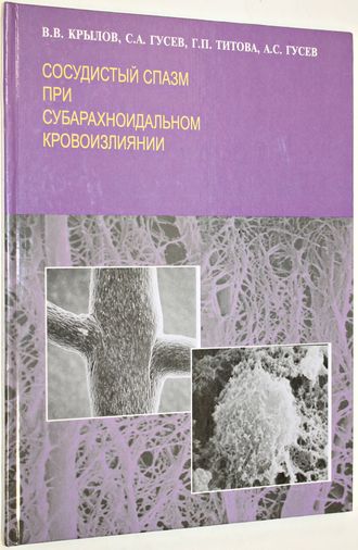 Крылов В.В., Гусев С.А. Сосудистый спазм при субарахноидальном кровоизлиянии. М.: Аким. 2001г.