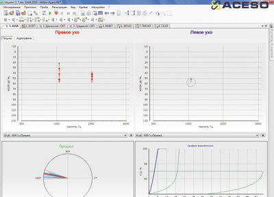Нейро-Аудио/СВП 2-канальный прибор для проведения объективной аудиометрии (КСВП)