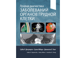 Лучевая диагностика заболеваний органов грудной клетки. Дигумарти С. Р. (комплект в 2-х книгах). &quot;Издательство Панфилова&quot;. 2023