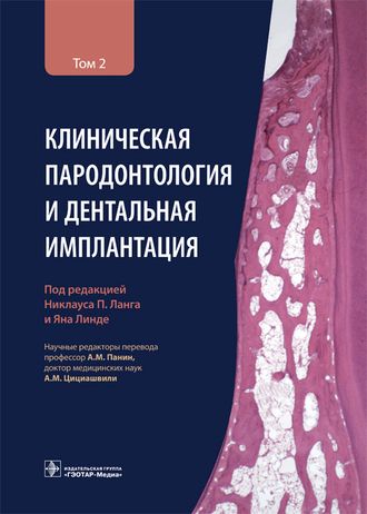 Клиническая пародонтология и дентальная имплантация. В 2-х томах. Том 2. Ланг Н.П. &quot;ГЭОТАР-Медиа&quot;. 2022