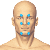 Тройничная зона (6 точек). ДЭНАС аппараты при лечение отита