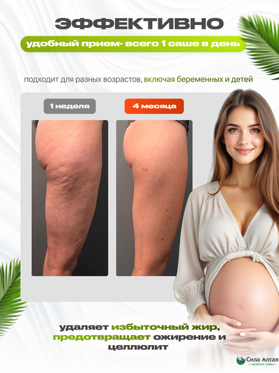 Максфит, комплекс для похудения