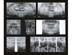 Papaya 3D 16x14 - компьютерный томограф без цефалостата Genoray Co., Ltd (Республика Корея)