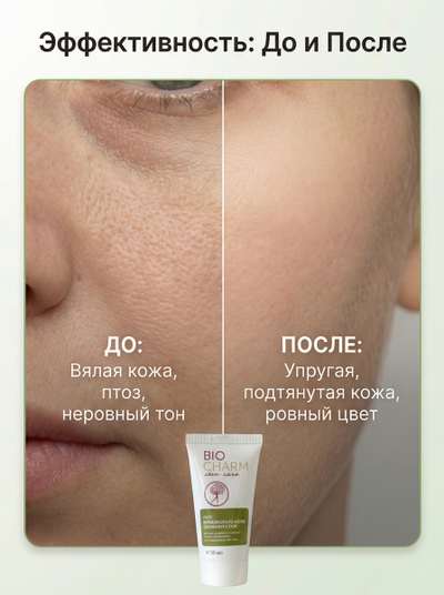 Крем ВИТАКОМПЛЕКС-АКТИВ, ЦВЕТОКОРРЕКТОР, 50 мл.