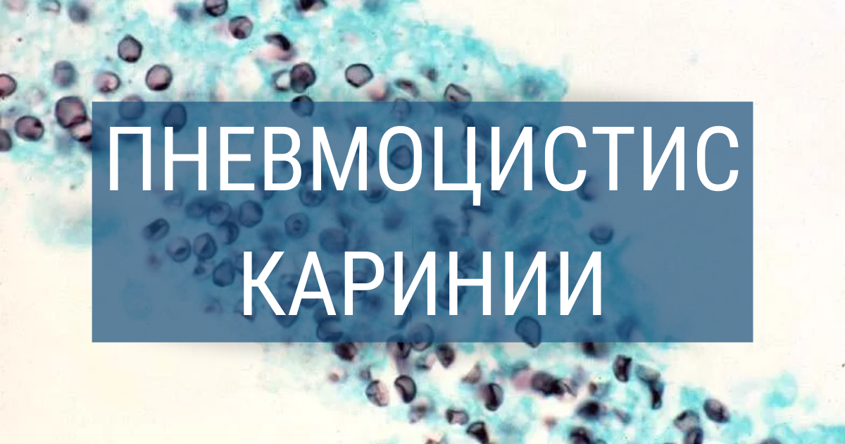 Пневмоцистис Каринии