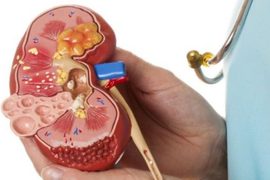 Нефрология