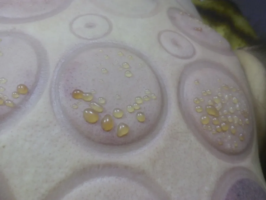 При применении вакуумных банок вирус герпеса выходит наружу.