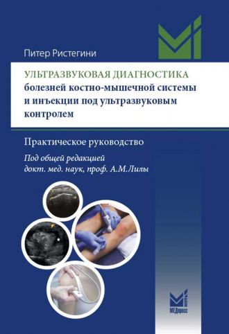 Ультразвуковая диагностика болезней костно-мышечной системы и инъекции под ультразвуковым контролем: практическое руководство. Ристегини Питер. &quot;МЕДпресс-информ&quot;. 2023