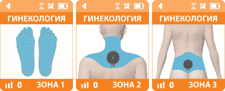 ДЭНАС ПКМ Гинекология ДЭНАС ПКМ Гинекология