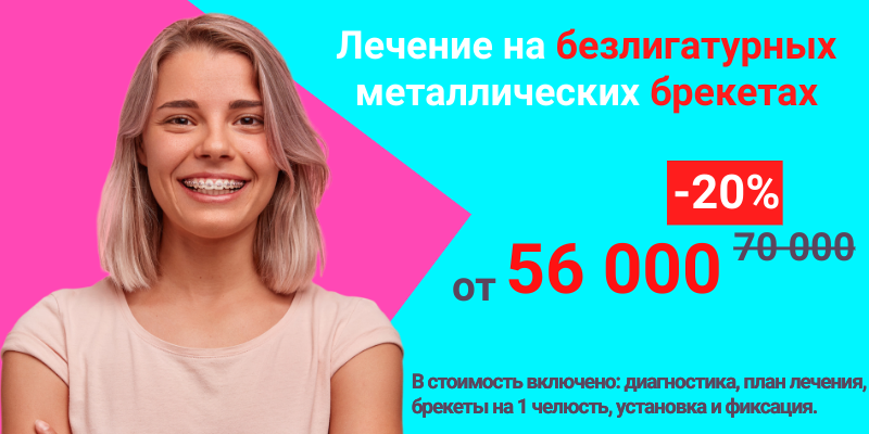 Лечение безлигатурными металлическими брекетами в Новосибирске, Адентал