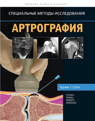 Артрография. Крим Р. Дж. &quot;Издательство Панфилова&quot;. 2020