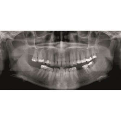 Gendex GXDP-300™ - Цифровая панорамная рентгенодиагностическая система | KAVO DENTAL (Германия)