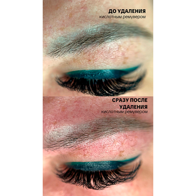 Ремувер с гликолевой кислотой 11% (GLYCOLIC ACID REMOVER) AS Company, 6 мл