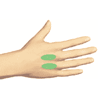 НЕЙРОДЭНС-ПКМ. Зона почек Су Джок