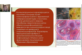 КУРС: &quot;Морфологическая диагностика заболеваний молочной железы&quot;