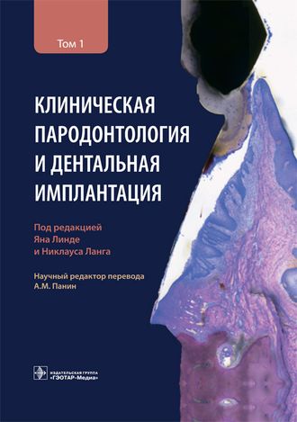 Клиническая пародонтология и дентальная имплантация. В 2-х томах. Том 1. Ланг Н.П. &quot;ГЭОТАР-Медиа&quot;. 2021