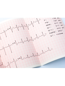 Электрокардиограмма ЭКГ