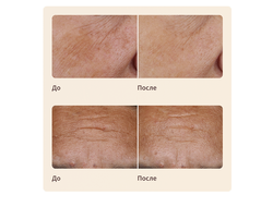 Artistry LongXevity Насыщенный восстанавливающий крем для лица, 50гр