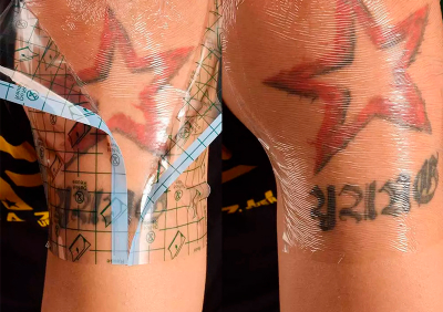 Плёнка для заживления COBRA (ширина 5см в нарезке)