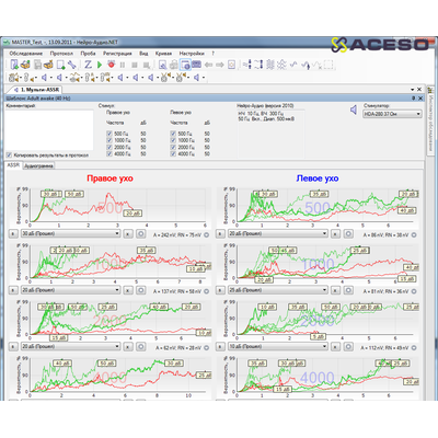 Нейро-Аудио/СВП 2-канальный прибор для проведения объективной аудиометрии (КСВП)