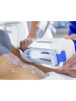 Аппараты криолиполиза